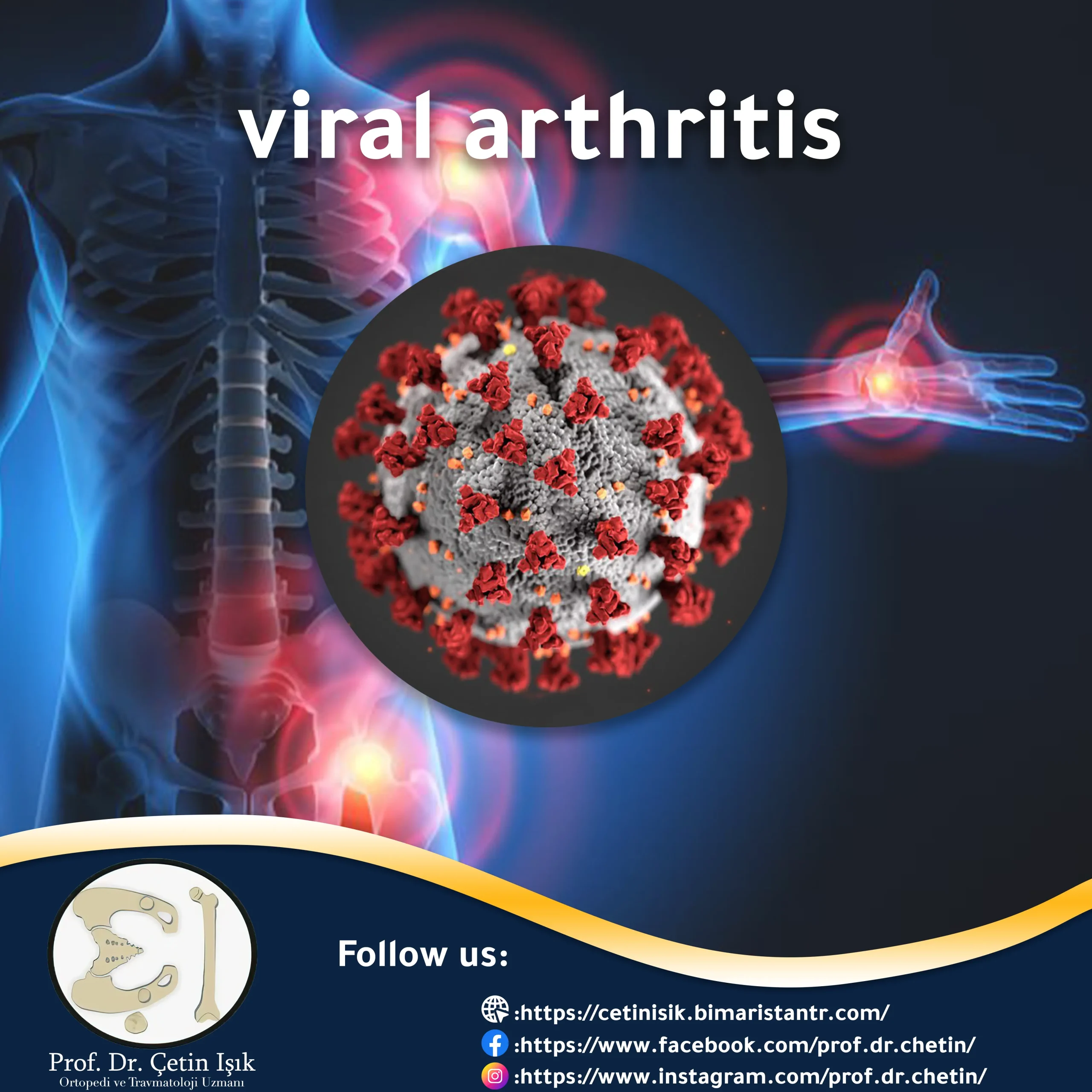 viral arthritis; Its symptoms and management