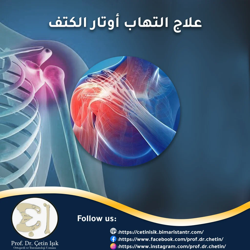 Shoulder tendonitis treatment and pain relief