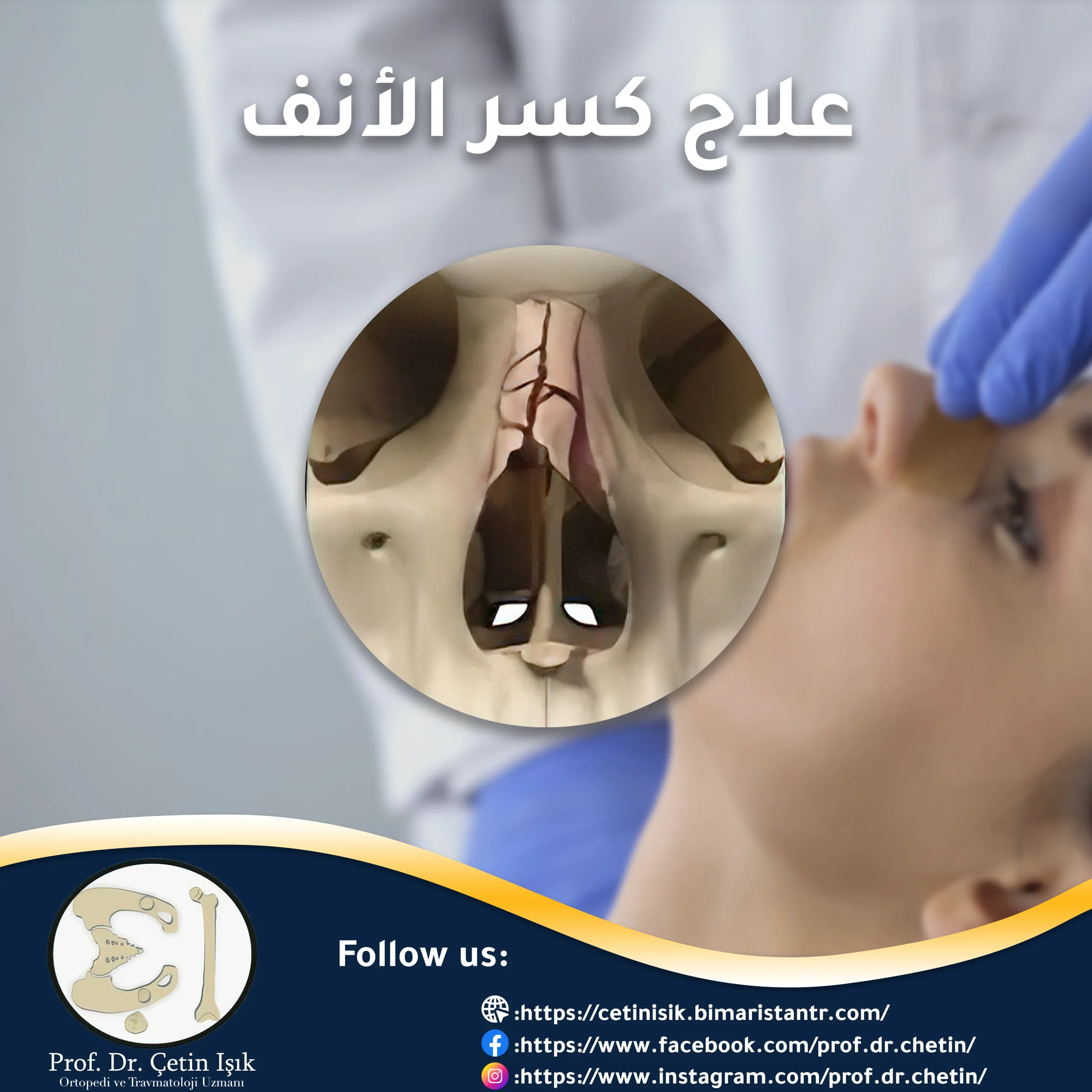 Nose fracture treatment: manual and surgical reduction