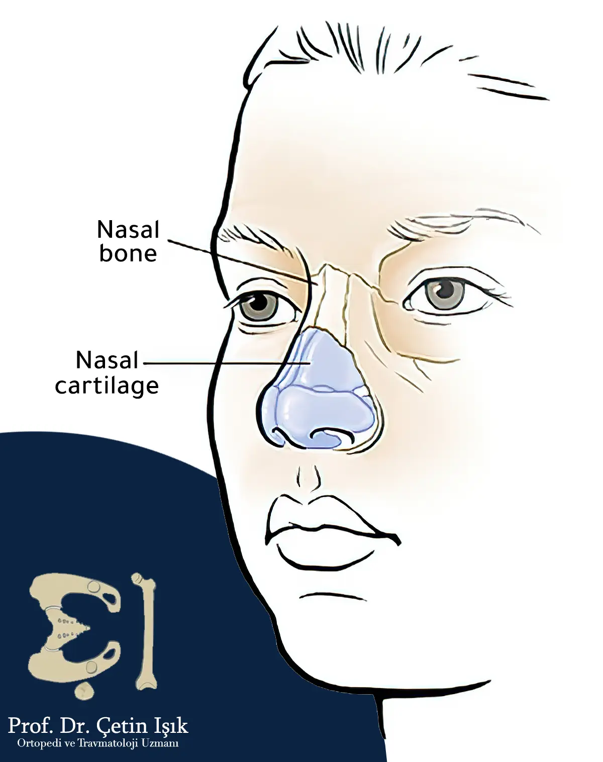 A picture showing the anatomy of the nose, as it consists of a bony part (upper) and a cartilaginous part (lower)