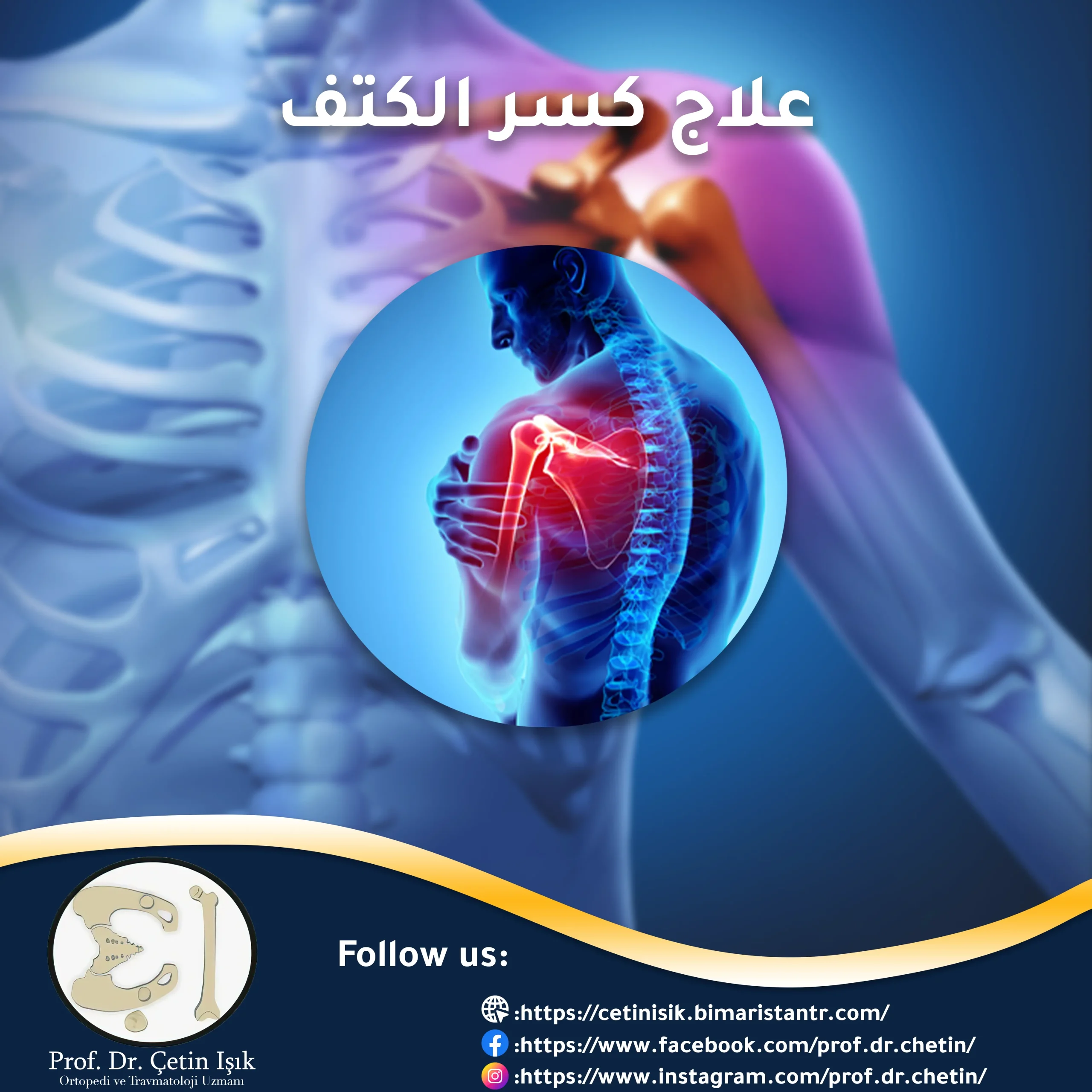 علاج كسر الكتف – عودة المفصل بشكل طبيعي