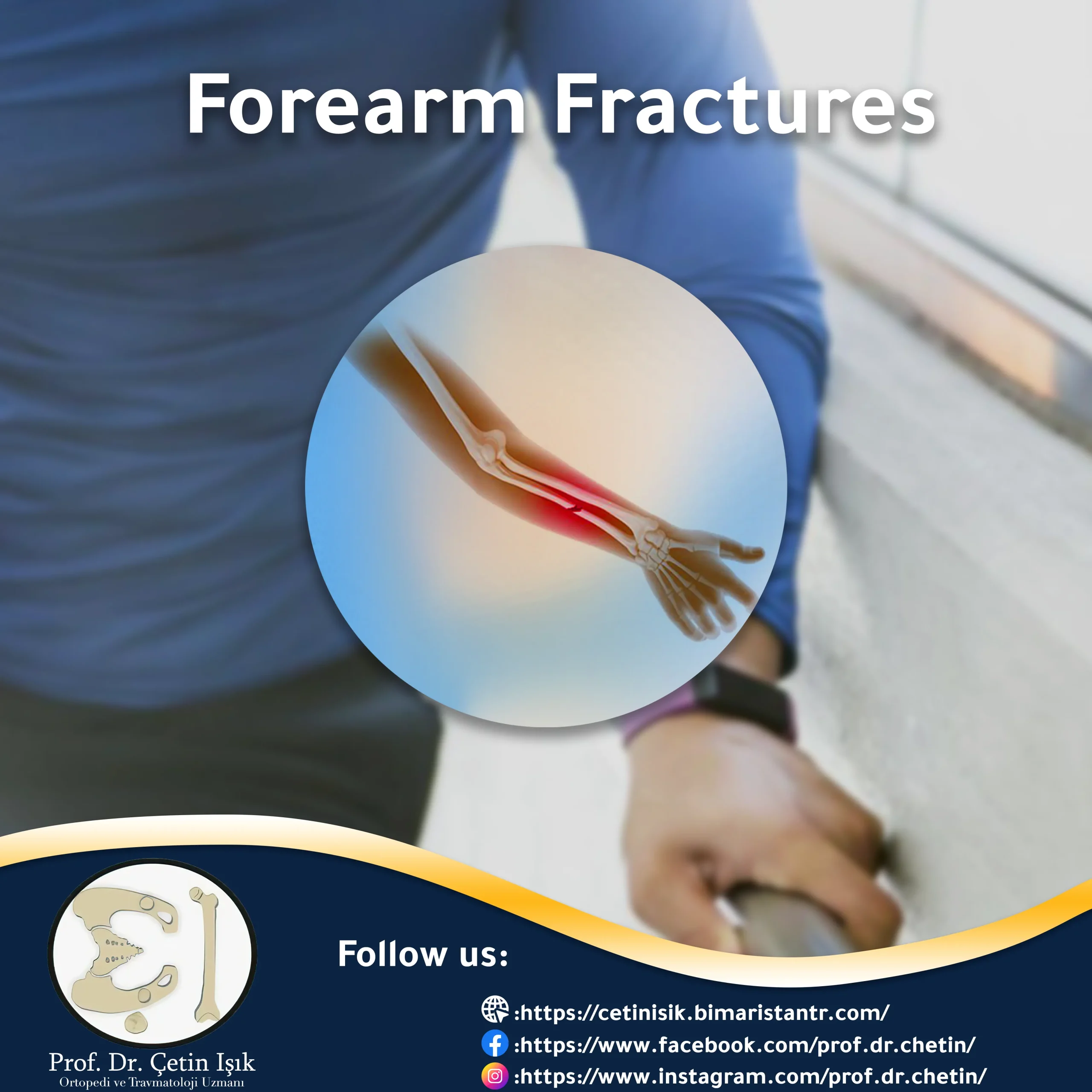 Cover image of the forearm fractures article