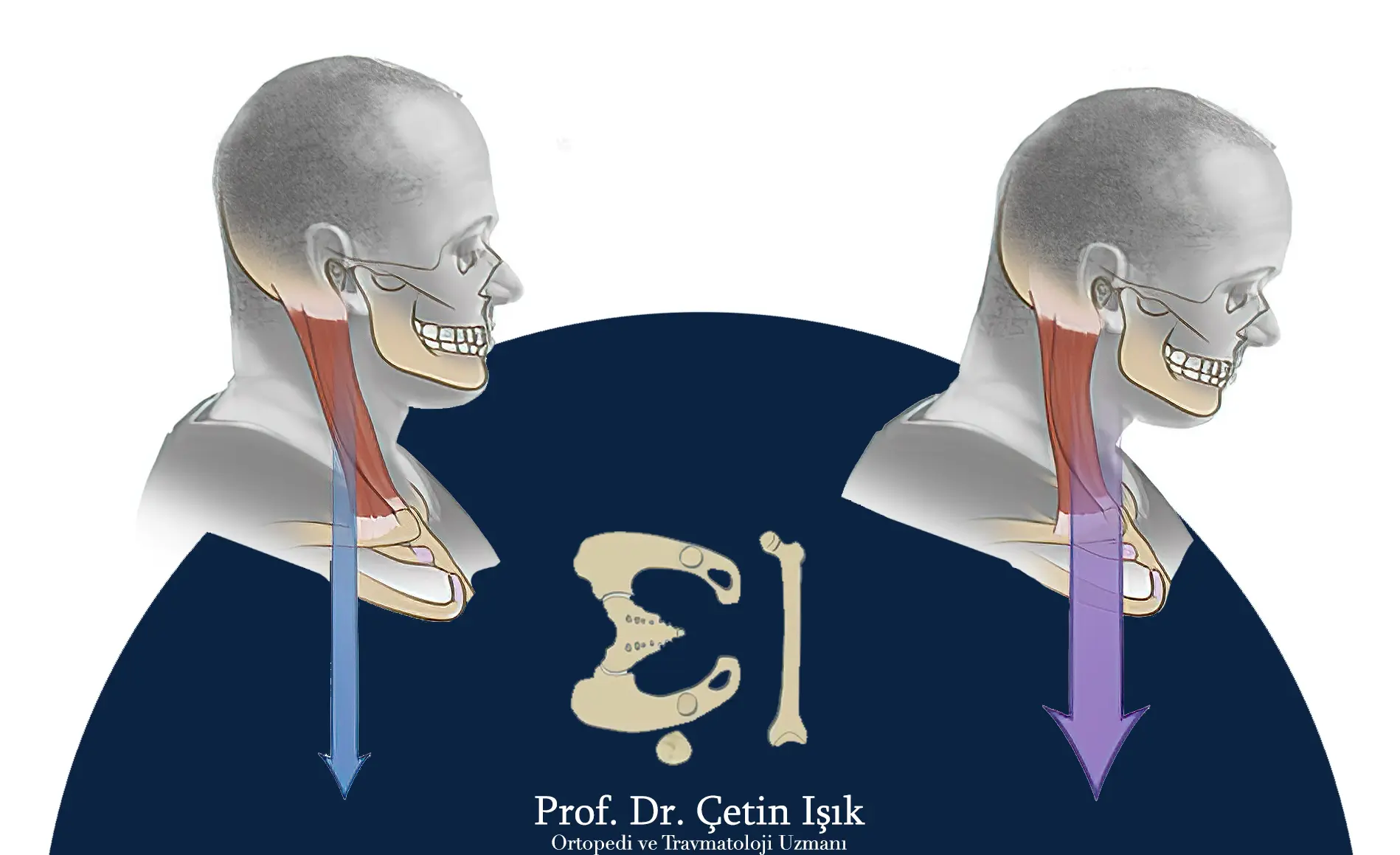An image showing the effect of the wrong position of the neck on the tendons by bending the head forward for a long time, which causes stress on the tendons