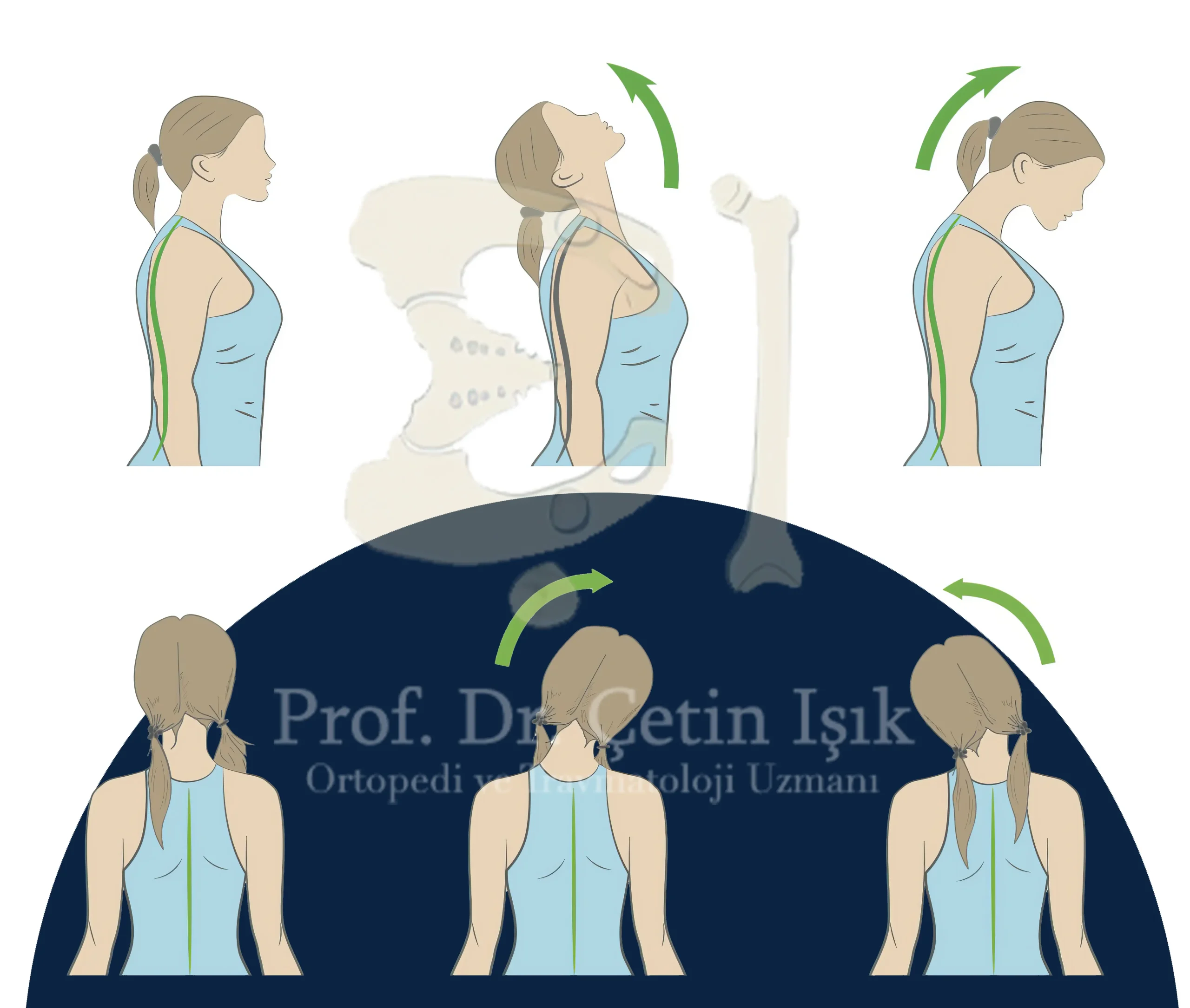 Image showing physiotherapy exercises that can be done to manage inflammation of the neck tendons. The exercises include an extension of the neck (backward), a flexion movement (forward), and tilting the head left and right