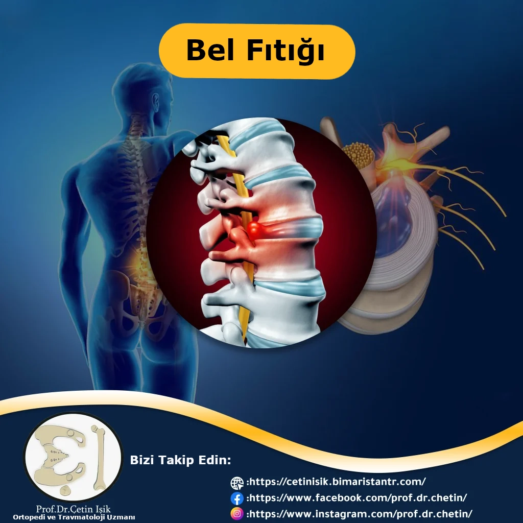 Bel fıtığı tedavisi ve nedenleri - Prof. Dr. Çetin Işık