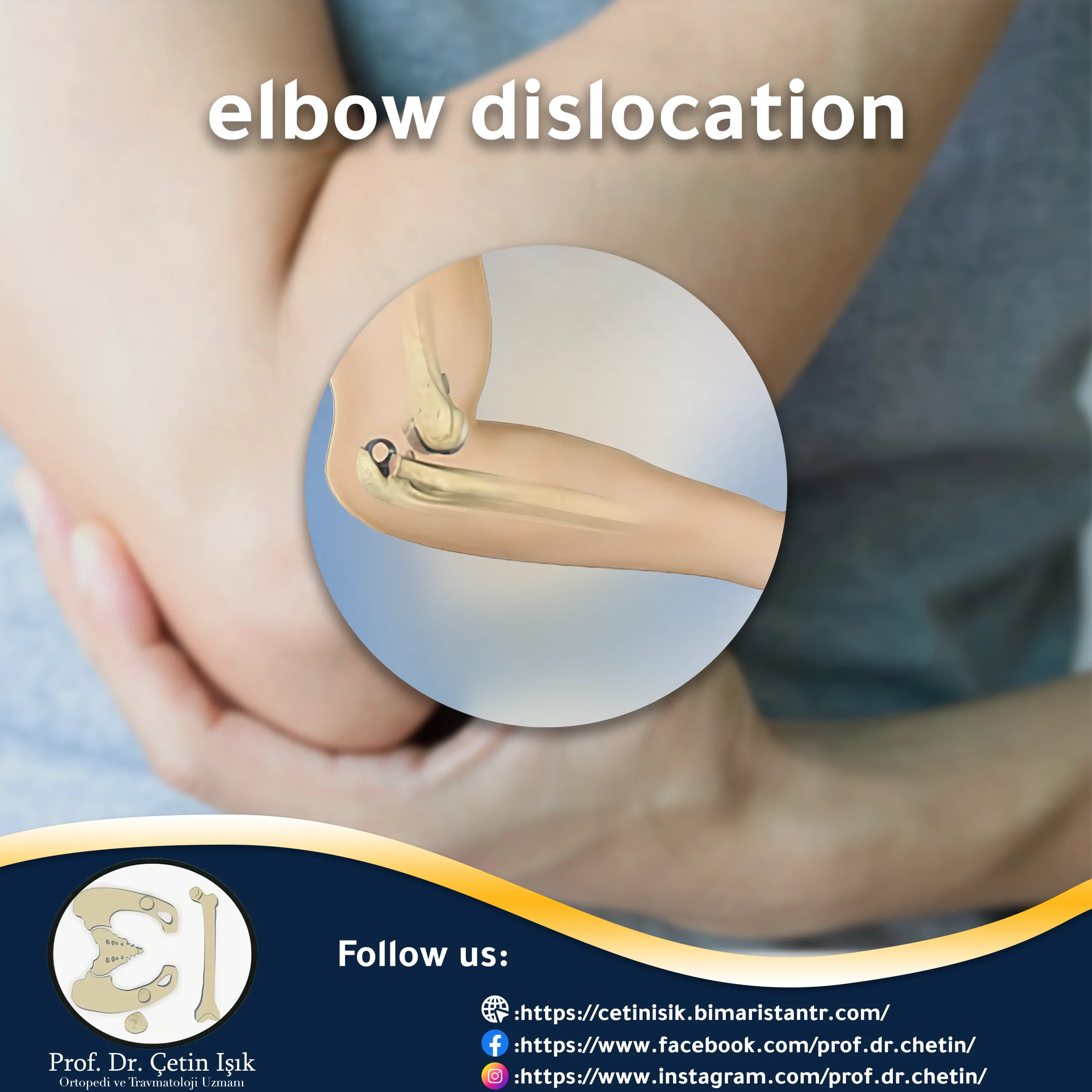 Cover image of the article "Elbow joint dislocation".