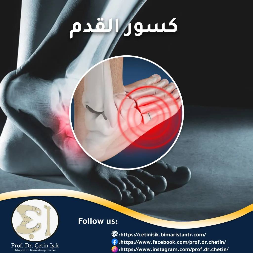 Cover image of the article "Fracture of the Foot".