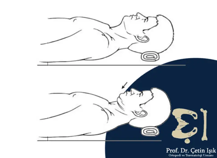 صورة توضح طريقة إجراء تمرين المحاور من خلال الاستلقاء ووضع قطعة قماش ملفوفة تحت الرأس ثم ثني الذقن نحو الأرض 
