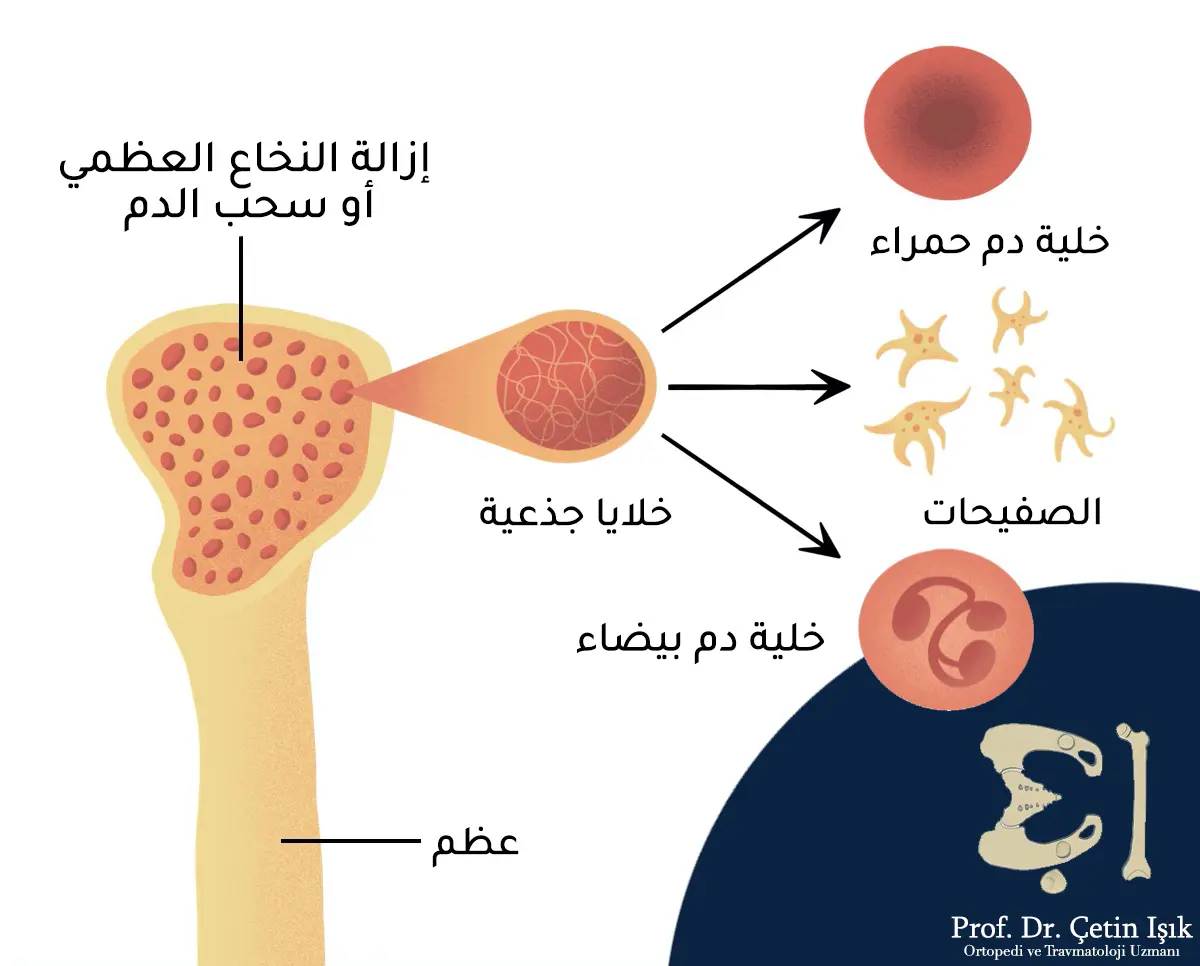 نلاحظ من الصورة أن النخاع العظمي يتكون من الخلايا الجذعية التي تشكل خلايا الدم الحمراء وخلايا الدم البيضاء والصفيحات