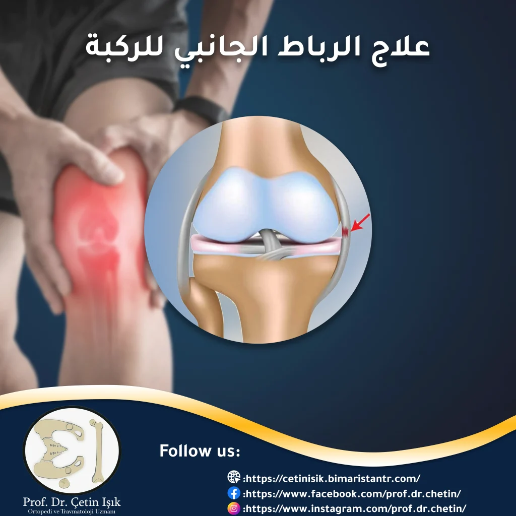 أفضل طرق علاج الرباط الجانبي للركبة