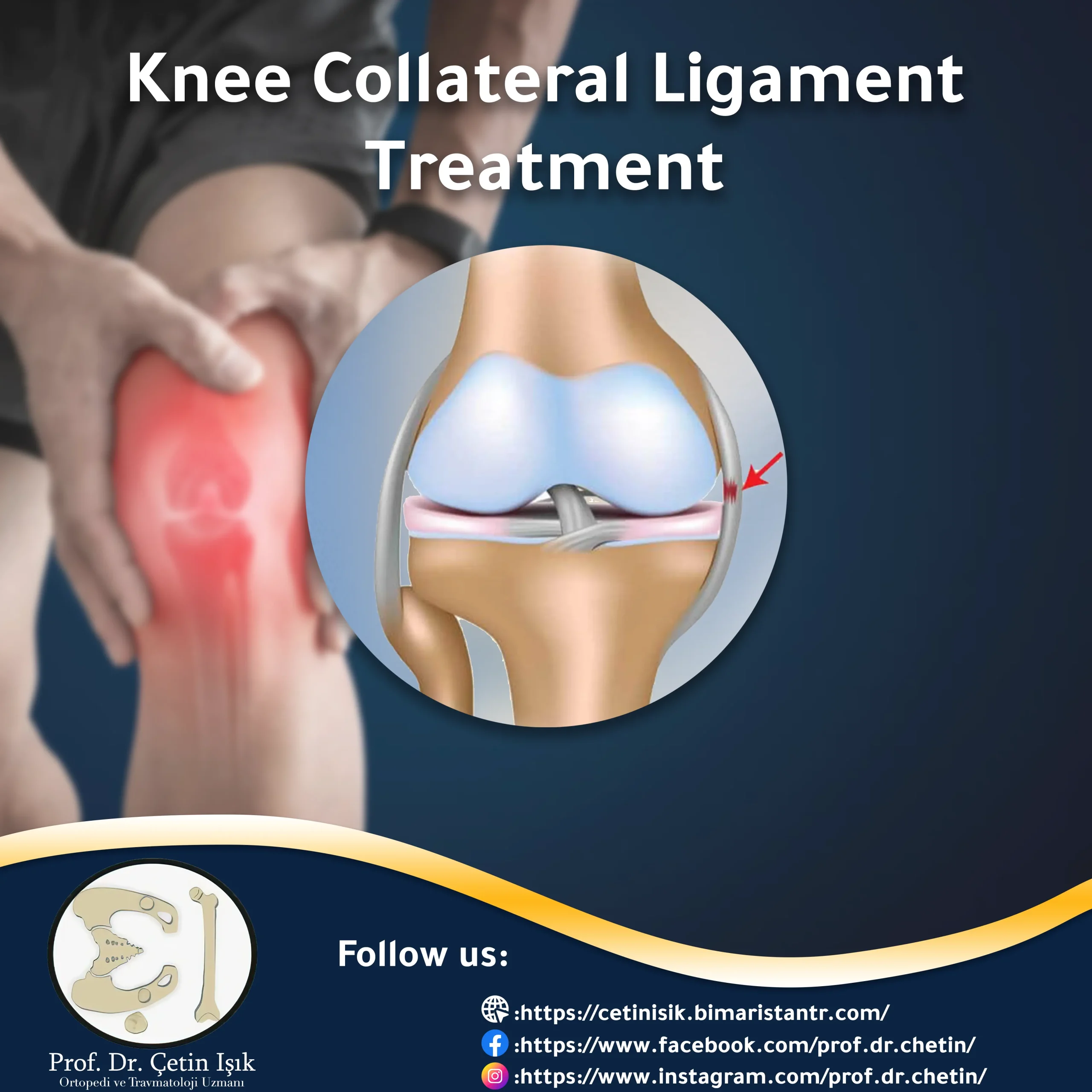 Best methods of knee collateral ligament treatment