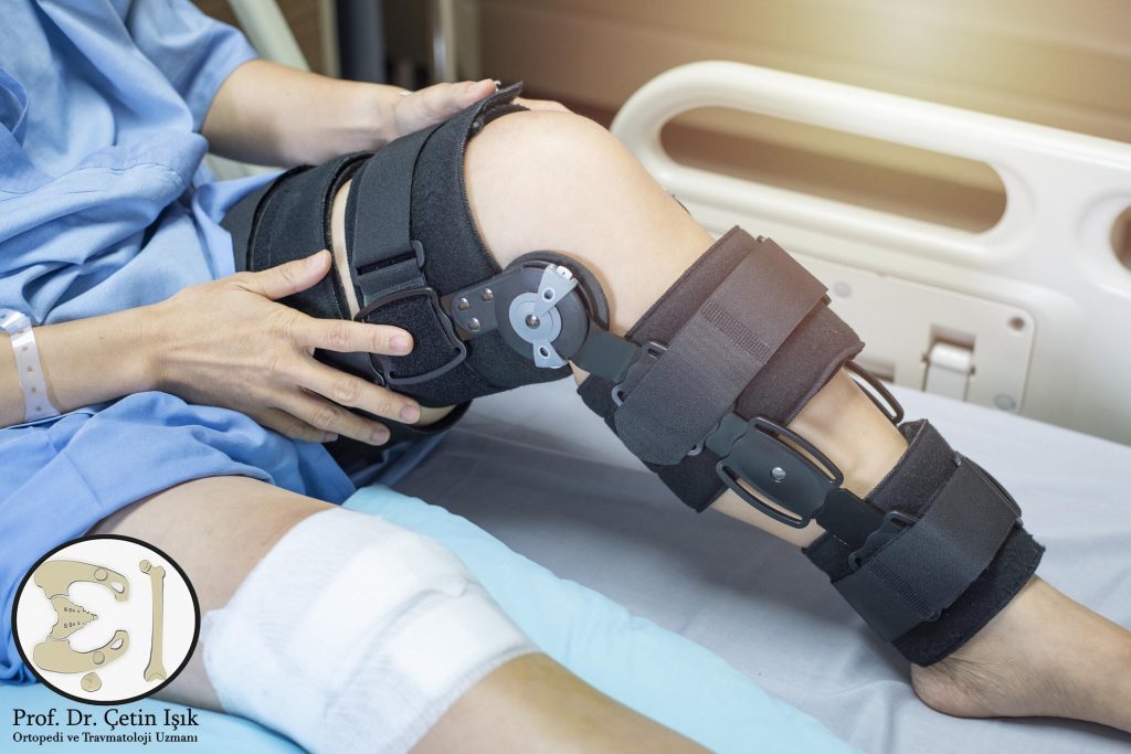The brace that the patient wears after knee arthroscopic surgery for protection