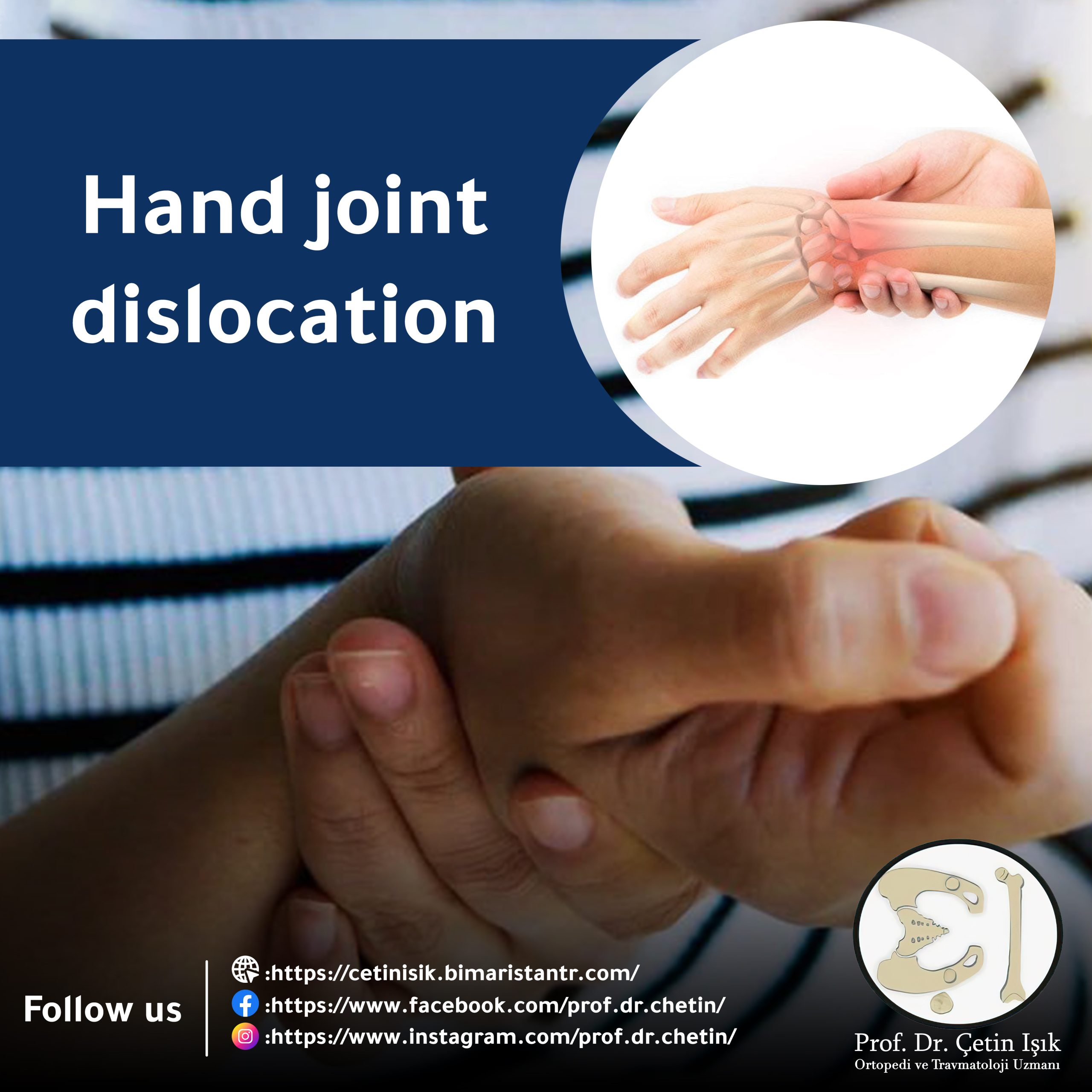 Cover image of the dislocation of the hand joint article