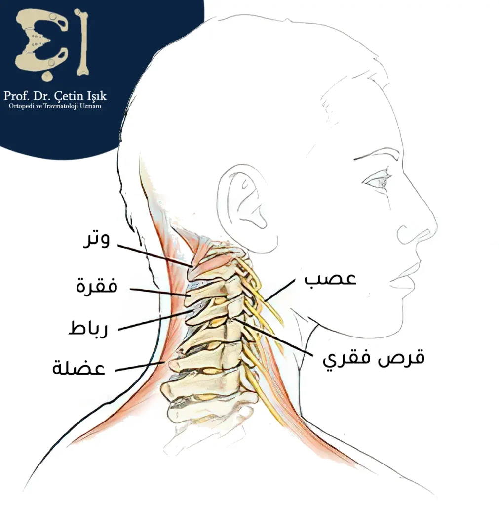 The components of the neck are the muscles, tendons, vertebrae, discs that separate the vertebrae, ligaments, and nerves