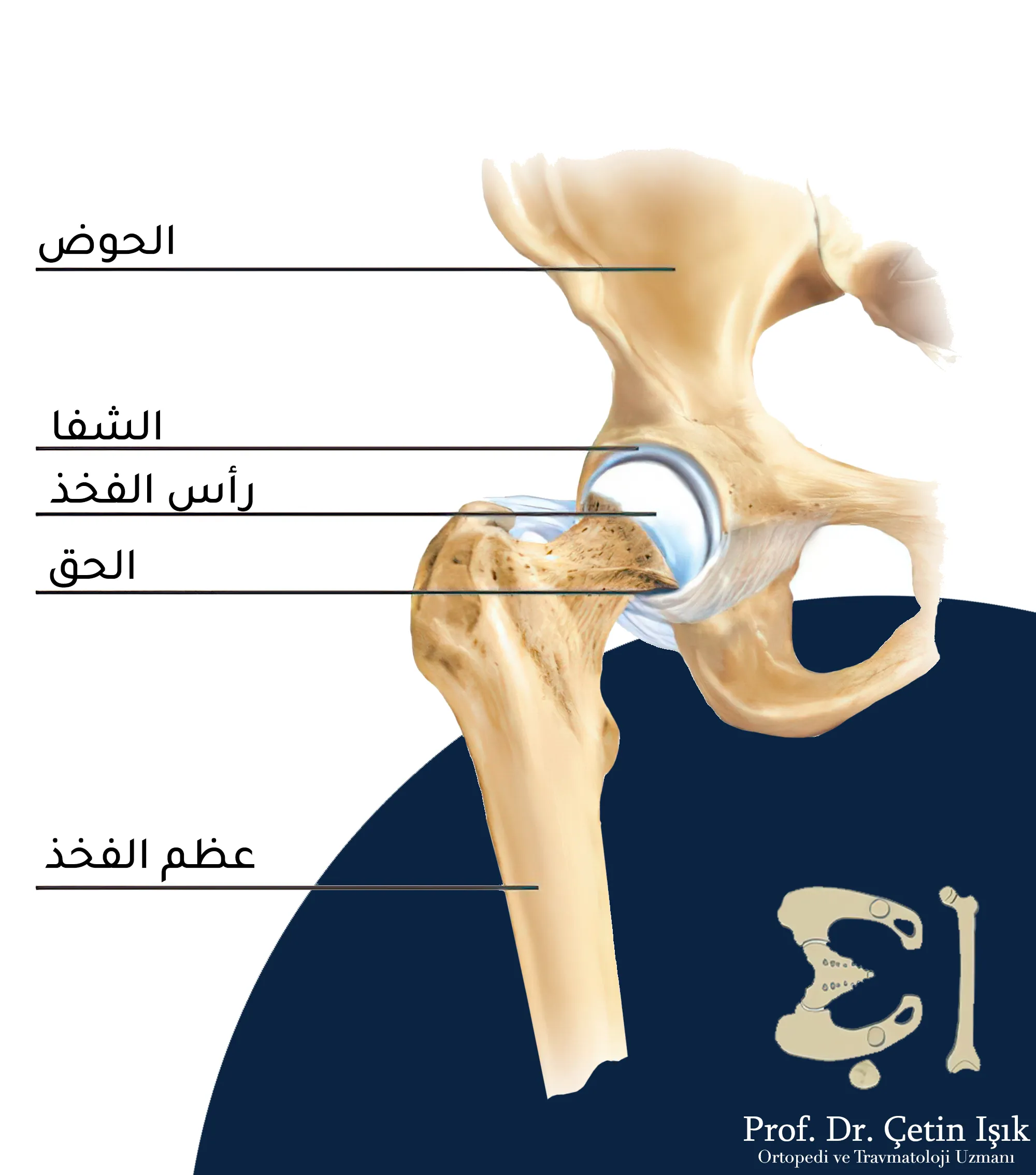 مكونات مفصل الورك، حيث، يشكل رأس عظم الفخذ الكرة أما الجوف فيتشكل من جزء من عظم الحوض وهو الجوف الحقي