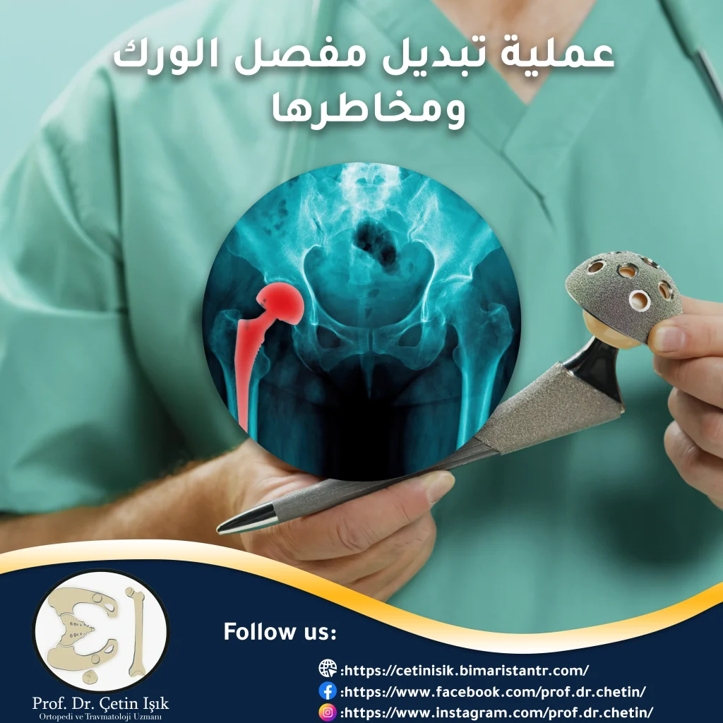 Information about hip replacement operations with an artificial joint in Türkiye
