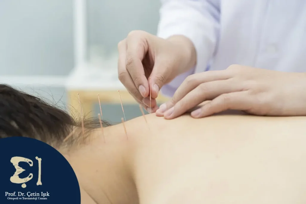Treatment with thin needles at specific points on the skin to relieve pain and speed up healing