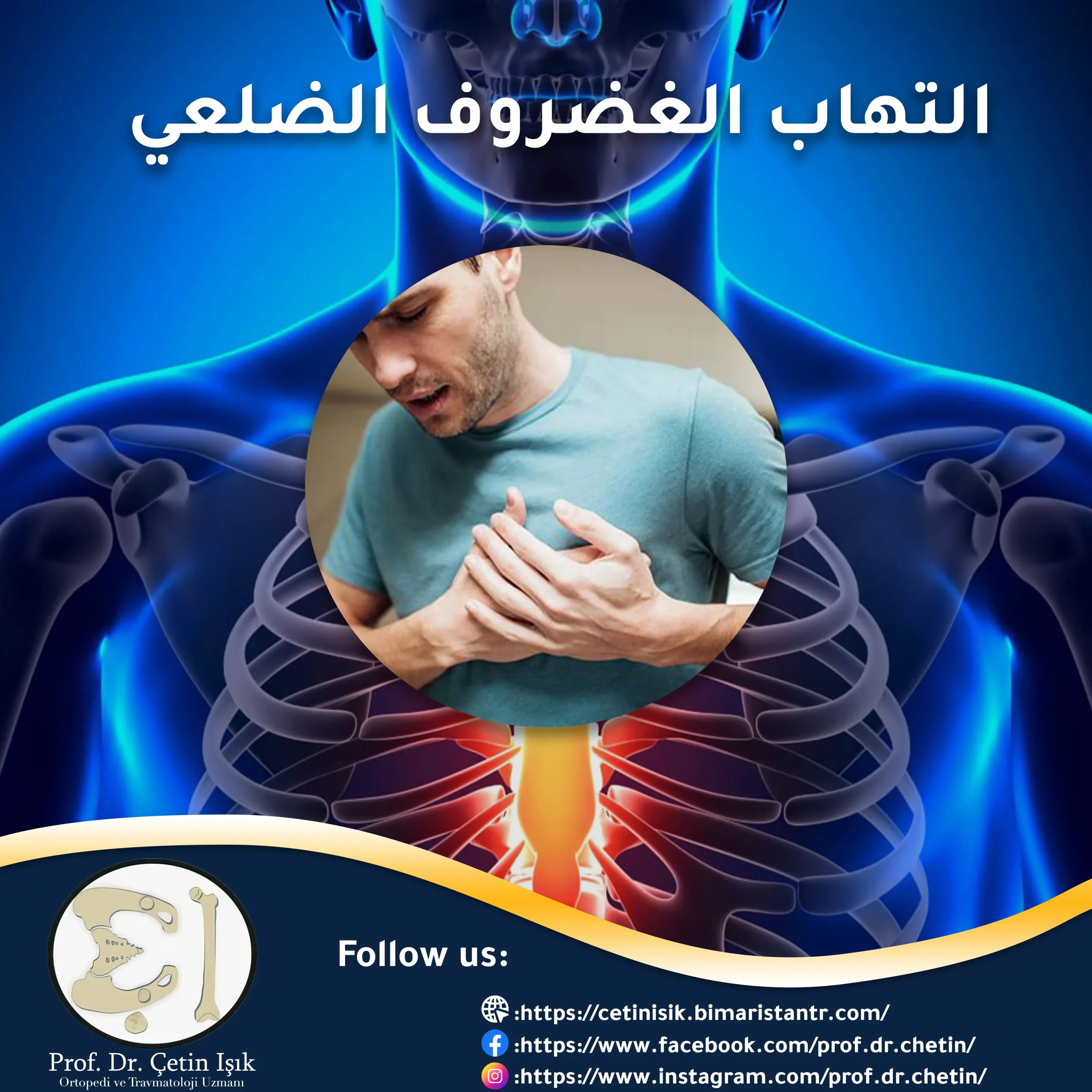 Costochondritis and methods of treating it