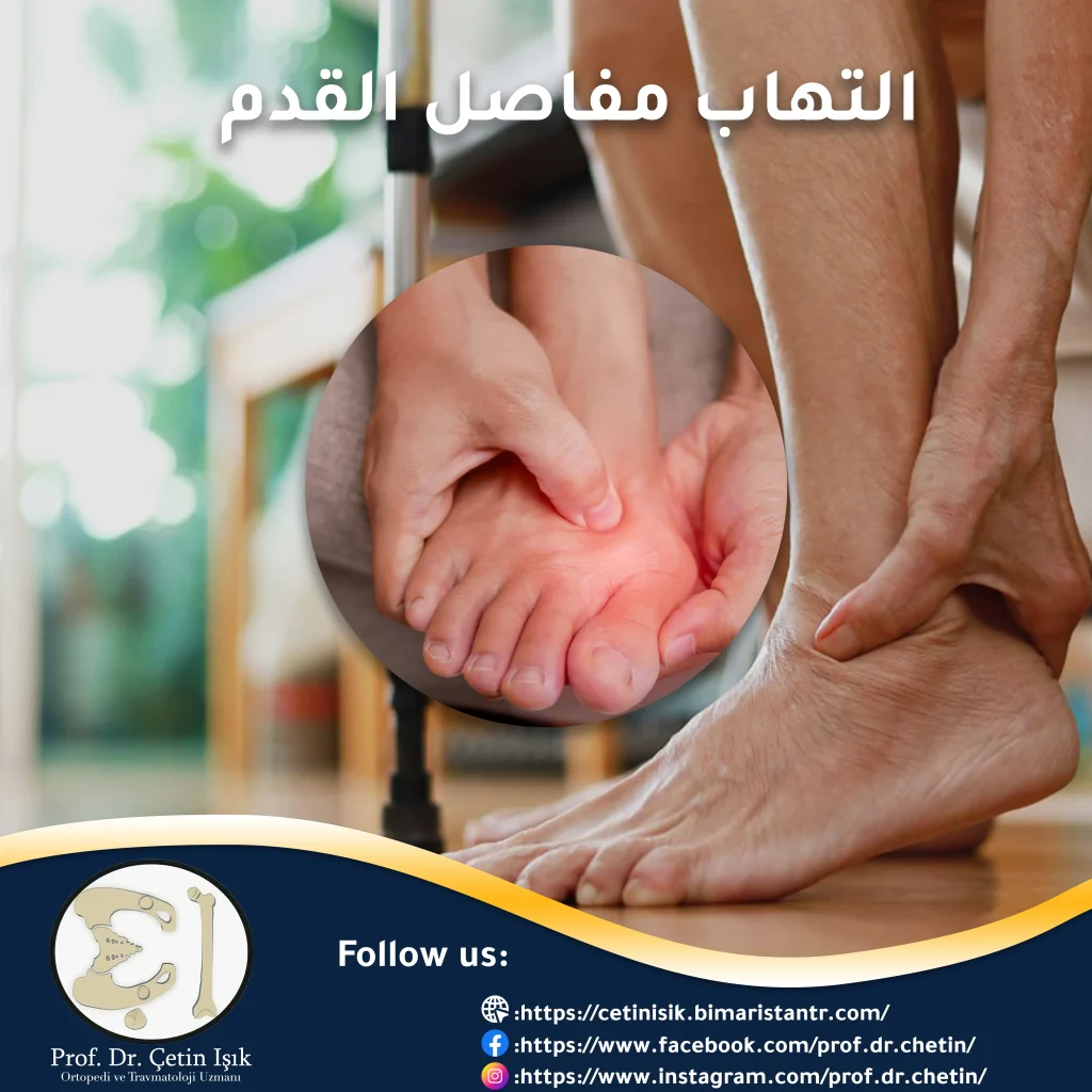 Types of foot arthritis and methods of treating it
